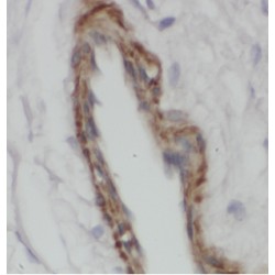 Arylsulfatase D (ARSD) Antibody