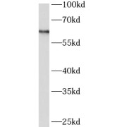 WB analysis of human placenta tissue, using ARSD antibody (1/500 dilution).