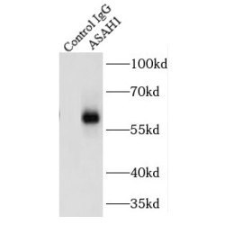 Acid Ceramidase (ASAH1) Antibody