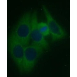 Ankyrin Repeat And SOCS Box Protein 13 (ASB13) Antibody