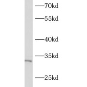 WB analysis of mouse spleen tissue, using ASB17 antibody (1/600 dilution).