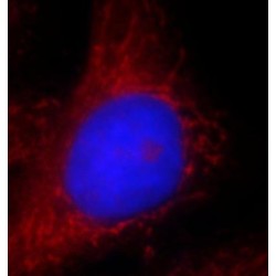 Activating Signal Cointegrator 1 Complex Subunit 2 (ASCC2) Antibody