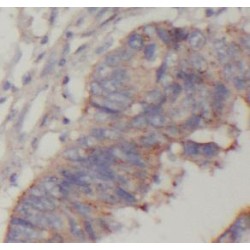 Activating Signal Cointegrator 1 Complex Subunit 2 (ASCC2) Antibody