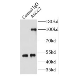 Activating Signal Cointegrator 1 Complex Subunit 2 (ASCC2) Antibody