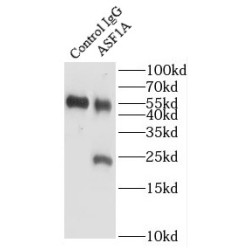 Histone Chaperone ASF1A (ASF1A) Antibody