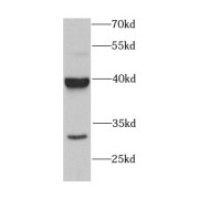 WB analysis of human brain tissue, using ASNA1 antibody (1/1000 dilution).