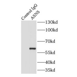 Asparagine Synthetase (ASNS) Antibody