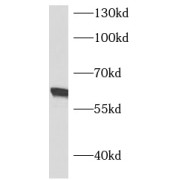 WB analysis of HeLa cells, using ASNS antibody (1/500 dilution).