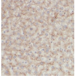 Argininosuccinate Synthase 1 (ASS1) Antibody