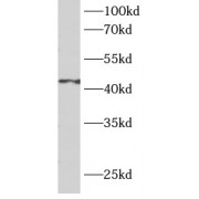 WB analysis of HeLa cells, using ASS1 antibody (1/2000 dilution).