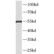 WB analysis of A431 cells, using ATF4 antibody (1/500 dilution).