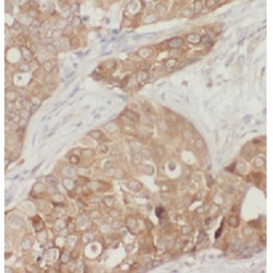 Cyclic AMP-Dependent Transcription Factor ATF-4 (ATF4) Antibody