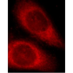 Activating Transcription Factor 6 (ATF6) Antibody