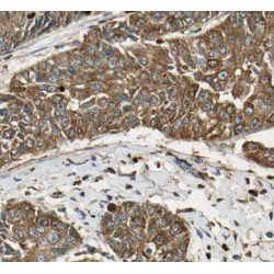 Activating Transcription Factor 6 (ATF6) Antibody