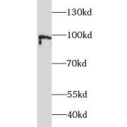 WB analysis of MCF-7 cells, using ATF6 antibody (1/3000 dilution).