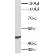 WB analysis of human bladder tissue, using ATG12 antibody (1/500 dilution).