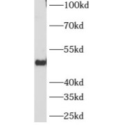 WB analysis of human bladder tissue, using ATG12 antibody (1/500 dilution).