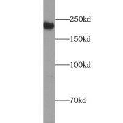 WB analysis of HeLa cells, using ATG2A antibody (1/300 dilution).