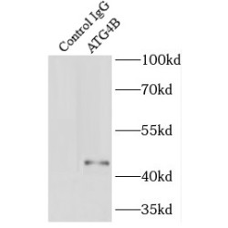 Autophagy Related 4B Cysteine Peptidase (ATG4B) Antibody