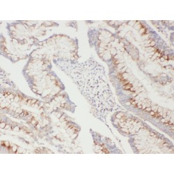 Autophagy Protein 5 (ATG5) Antibody