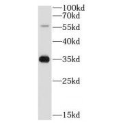 WB analysis of SW620 cells, using ATP4B antibody (1/1000 dilution).