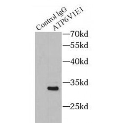 V-Type Proton ATPase Subunit E 1 (ATP6V1E1) Antibody