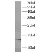 WB analysis of Jurkat cells, using ATP6V1G1 antibody (1/500 dilution).