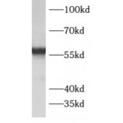 WB analysis of human heart tissue, using ATPB antibody (1/500 dilution).