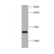 WB analysis of human liver tissue, using ATPIF1 antibody (1/1000 dilution).
