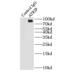 ATR-Interacting Protein (ATRIP) Antibody