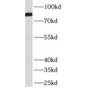 WB analysis of MCF7 cells, using ATRIP antibody (1/1000 dilution).