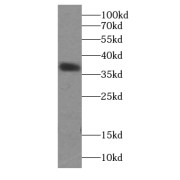 WB analysis of mouse pancreas tissue, using ATX3, ATXN3 antibody (1/500 dilution).