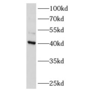 Western blot analysis of Mouse brain tissue subjected to SDS-PAGE, using ATXN3L Antibody (1/500 dilution).