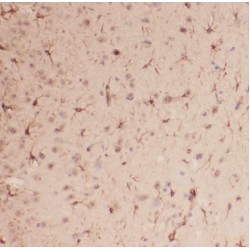 Methylglutaconyl-CoA Hydratase, Mitochondrial (AUH) Antibody