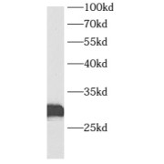 WB analysis of human brain tissue, using AUH antibody (1/600 dilution).