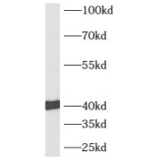 WB analysis of K-562 cells, using AUP1 antibody (1/400 dilution).