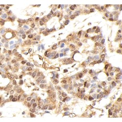 Aurora Kinase B (AURKB) Antibody