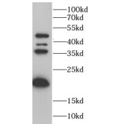 WB analysis of Mouse liver, using Aurora B antibody (1/1000 dilution).