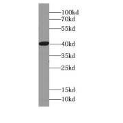 WB analysis of human plasma tissue, using AZGP1 antibody (1/1000 dilution).