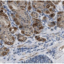 5-Azacytidine-Induced Protein 2 (AZI2) Antibody