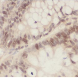 B23 Antibody