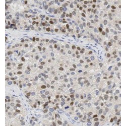 B23 Antibody