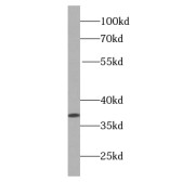 WB analysis of HeLa cells, using B23 antibody (1/20000 dilution).