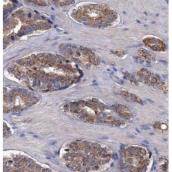 Beta-2-Microglobulin (B2M) Antibody