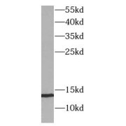 WB analysis of Raji cells, using B2M antibody (1/4000 dilution).