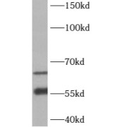 WB analysis of HEK-293 cells, using B3GALNT2 antibody (1/500 dilution).