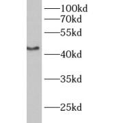 WB analysis of mouse brain tissue, using B3GALT2 antibody (1/800 dilution).