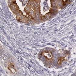 Beta-1,3-Glucosyltransferase (B3GALTL) Antibody