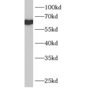 WB analysis of COLO 320 cells, using B4GALNT1 antibody (1/400 dilution).