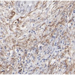 Beta-1,4 N-Acetylgalactosaminyltransferase 2 (B4GALNT2) Antibody